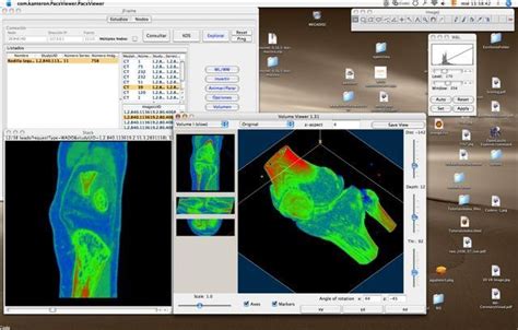 Download Sante DICOM Worklist